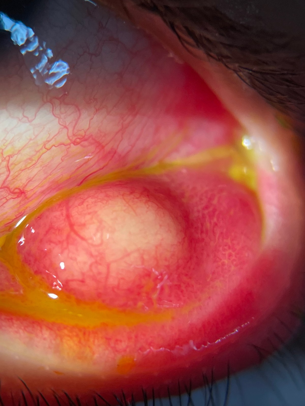 Foto de paciente de Vision Clinic®.