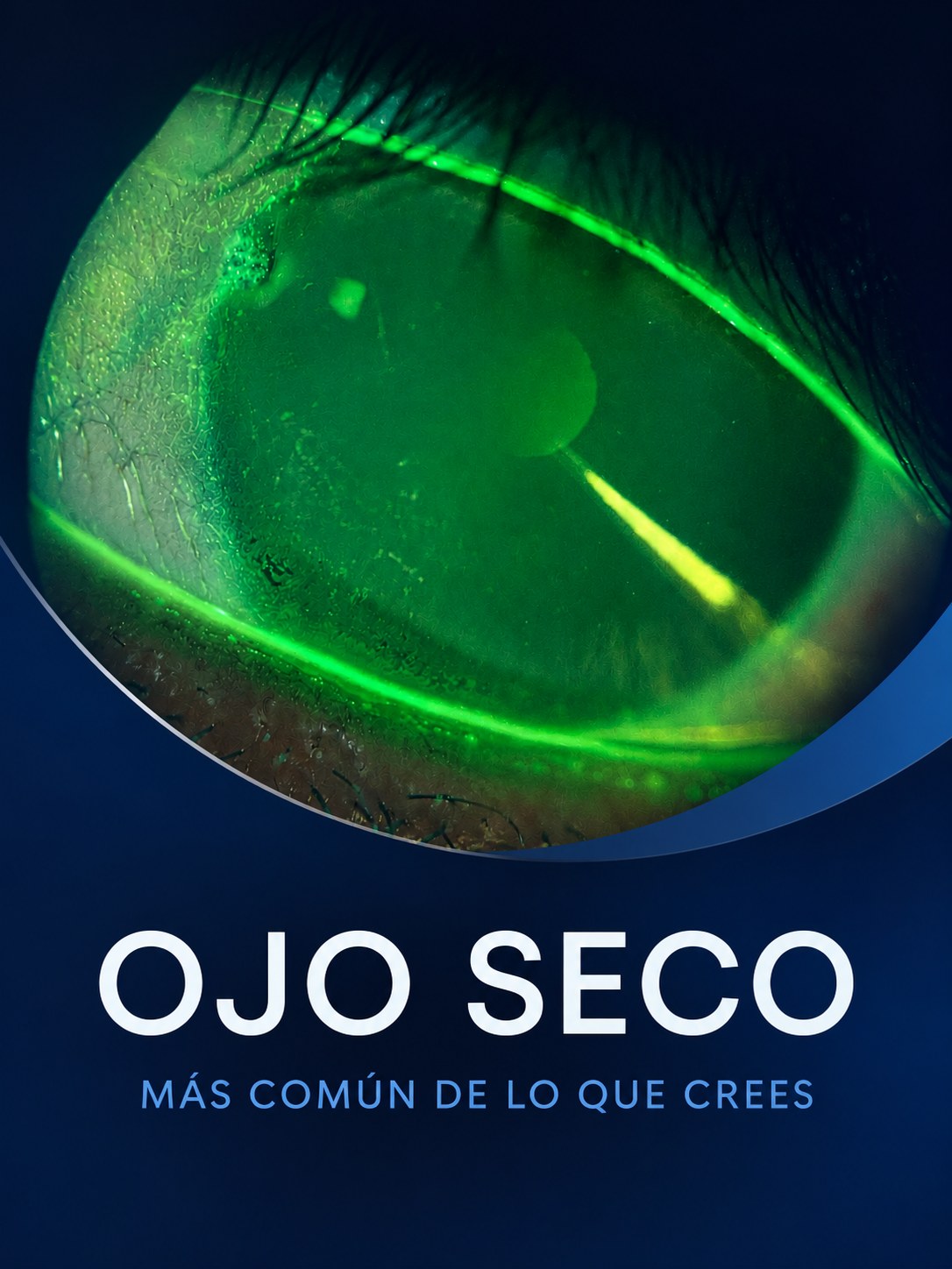 Ojo Seco