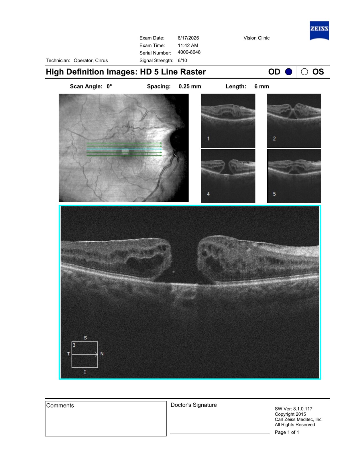 Ejemplo real del estudio en Vision Clinic