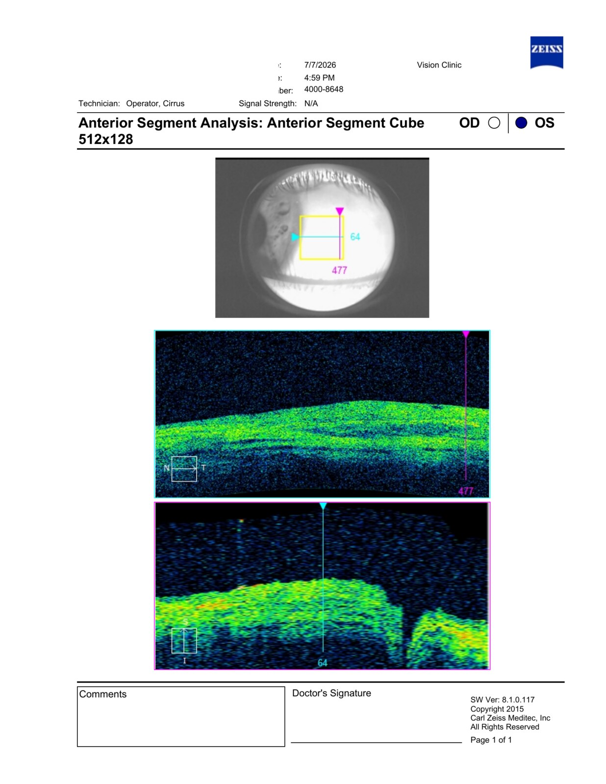 Real example of the study at Vision Clinic