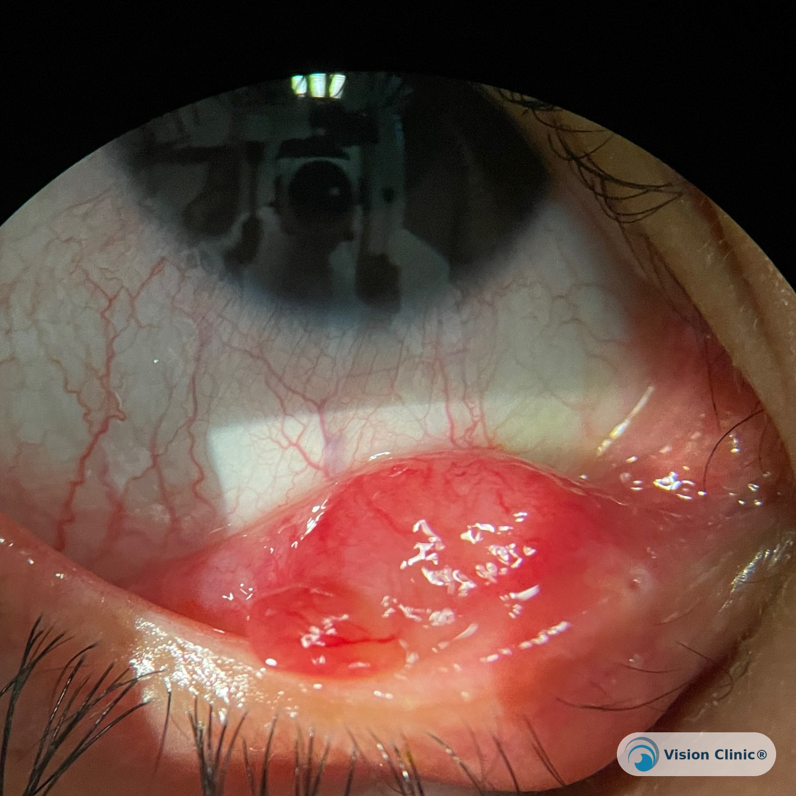 Vision Clinic® patient photo.